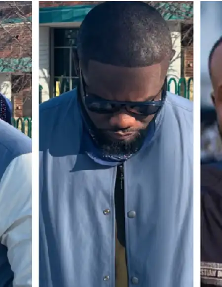 Prince David Osei undergoes hair transplant