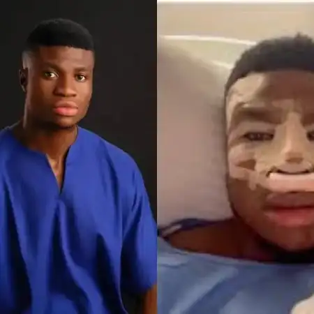 I didn’t pay for my nose surgery – Nigerian comedian Zicsaloma clarifies